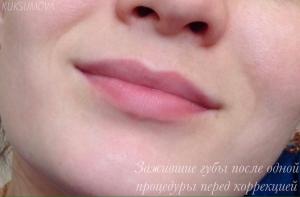 Зажившие губы после одной процедуры татуажа Куксумова